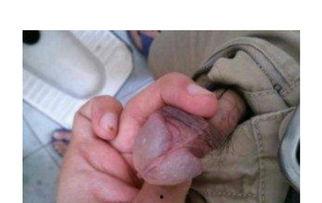 生殖器照片,从照片中探寻人体奥秘